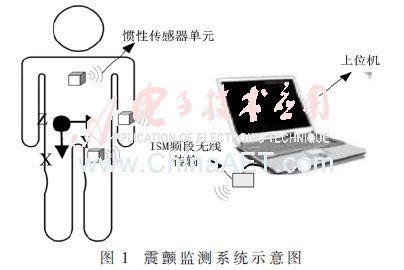 qrs1-t1.gif qrs1-t1.gif