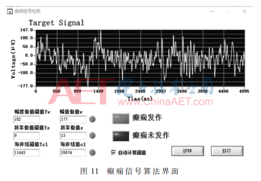 ck1-t11.gif ck1-t11.gif