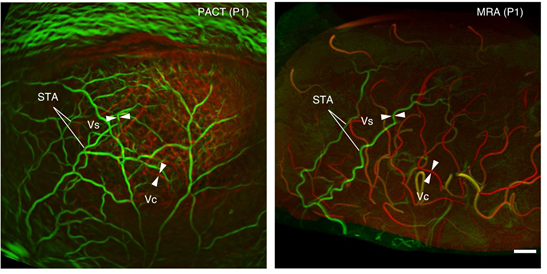 60bd87fa4990a-thumb.png 60bd87fa4990a-thumb.png