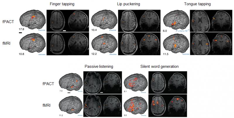60bd87fa49aca-thumb.png 60bd87fa49aca-thumb.png