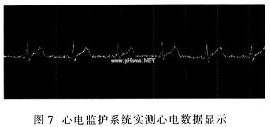 心电监护系统显示界面