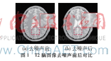 基于IRTK和VTK的医学图像配准与可视化系统