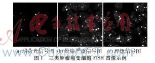 肿瘤癌变细胞FISH图像分析系统的研究
