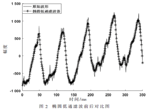 基于RNN的脉搏波血压计的研究与实现