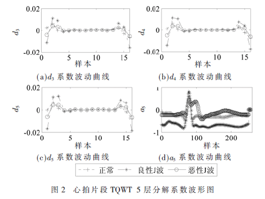 基于多特征融合的J波分类模型