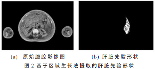 多图像融合的连续腹腔影像图像分割