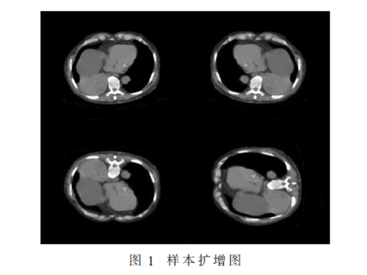 卷积神经网络在肝包虫病CT图像诊断中的应用