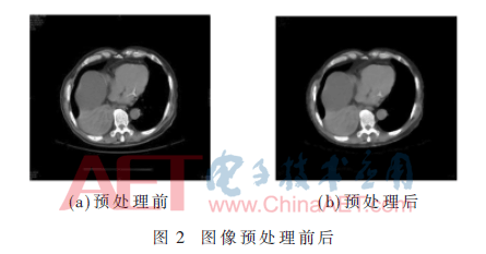 rgzn3-t2.gif
