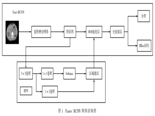 Faster RCNN和LGDF结合的肝包虫病CT图像病灶分割